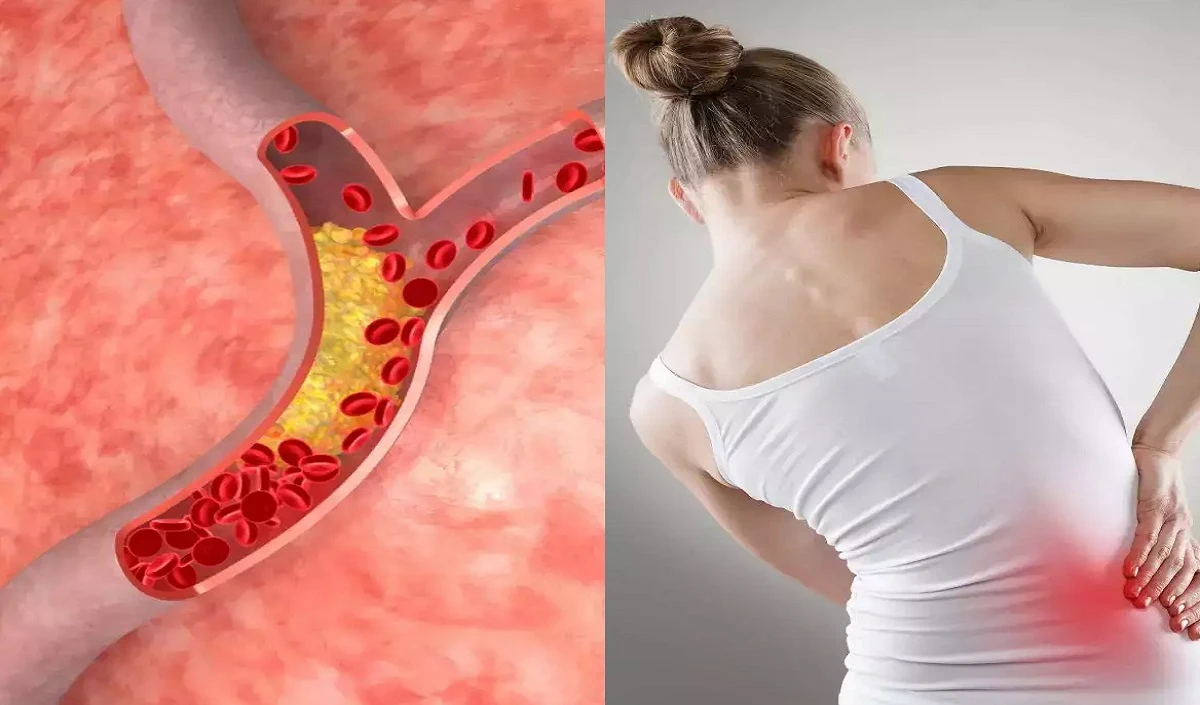 High Cholesterol Remedy: नसों में जम गया है गंदा कोलेस्ट्रॉल तो अपनाएं आयुर्वेदिक तरीका, ऐसे साफ हो जाएगी गंदगी