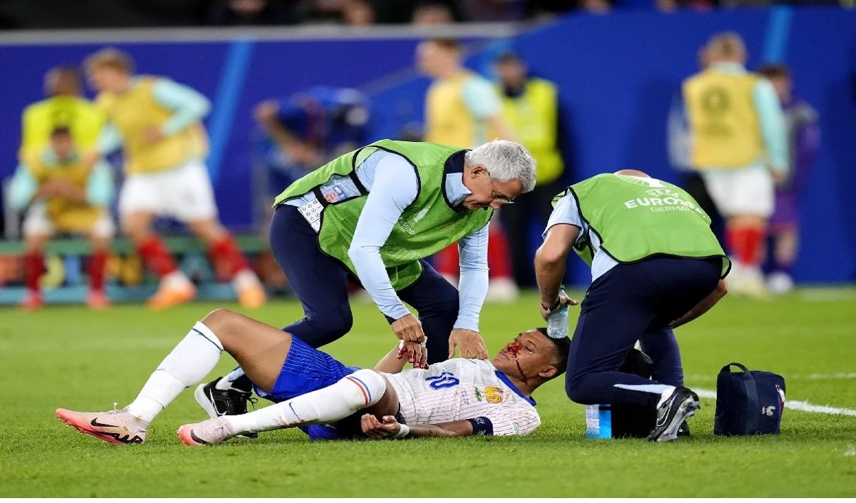 फ्रांस ने ऑस्ट्रिया को 1-0 से हराया, किलियन एमबापे की नाक में लगी चोट