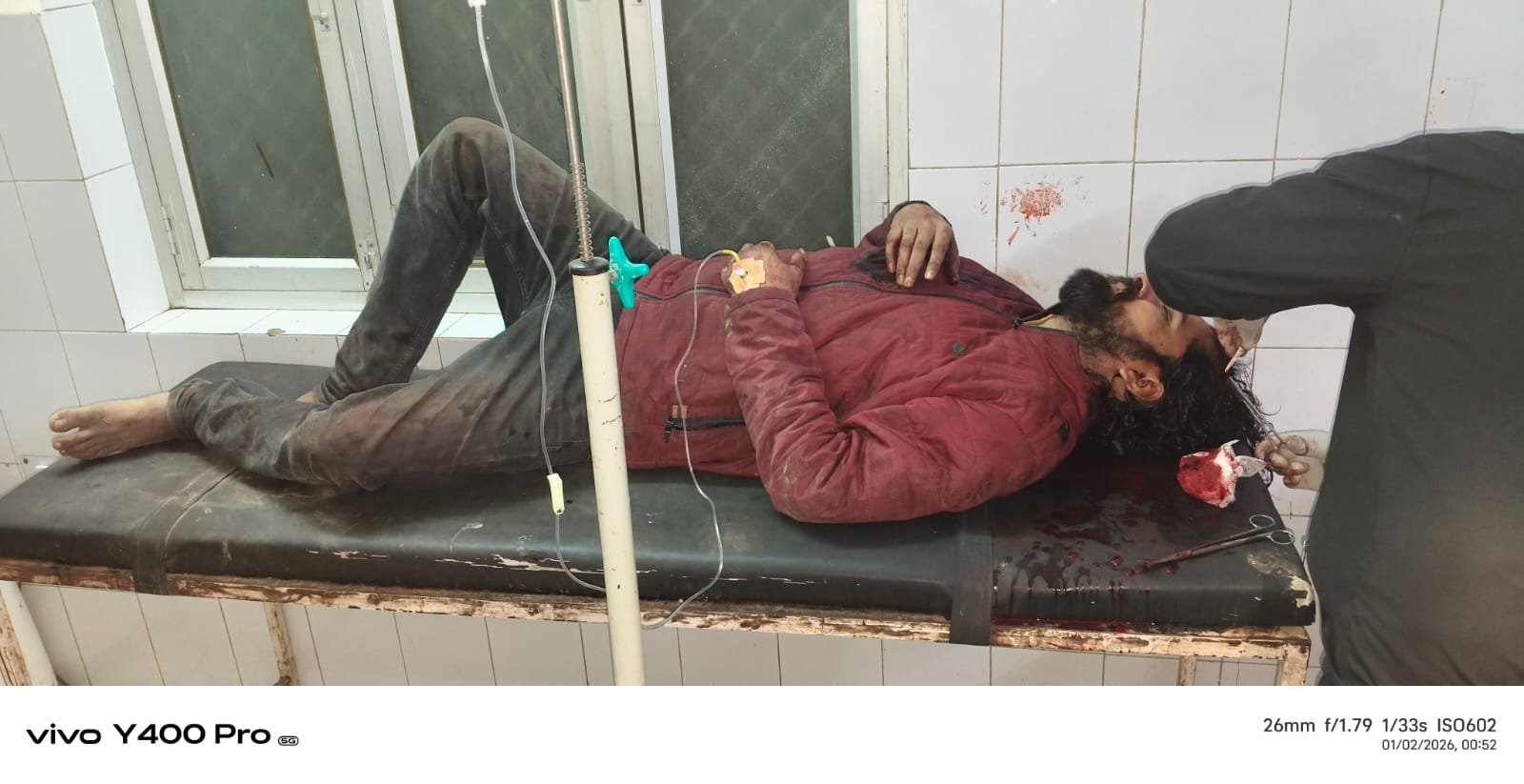 हल्दी–सहतवार मार्ग पर सड़क हादसा, एक युवक की मौत, दूसरा बीएचयू में भर्ती