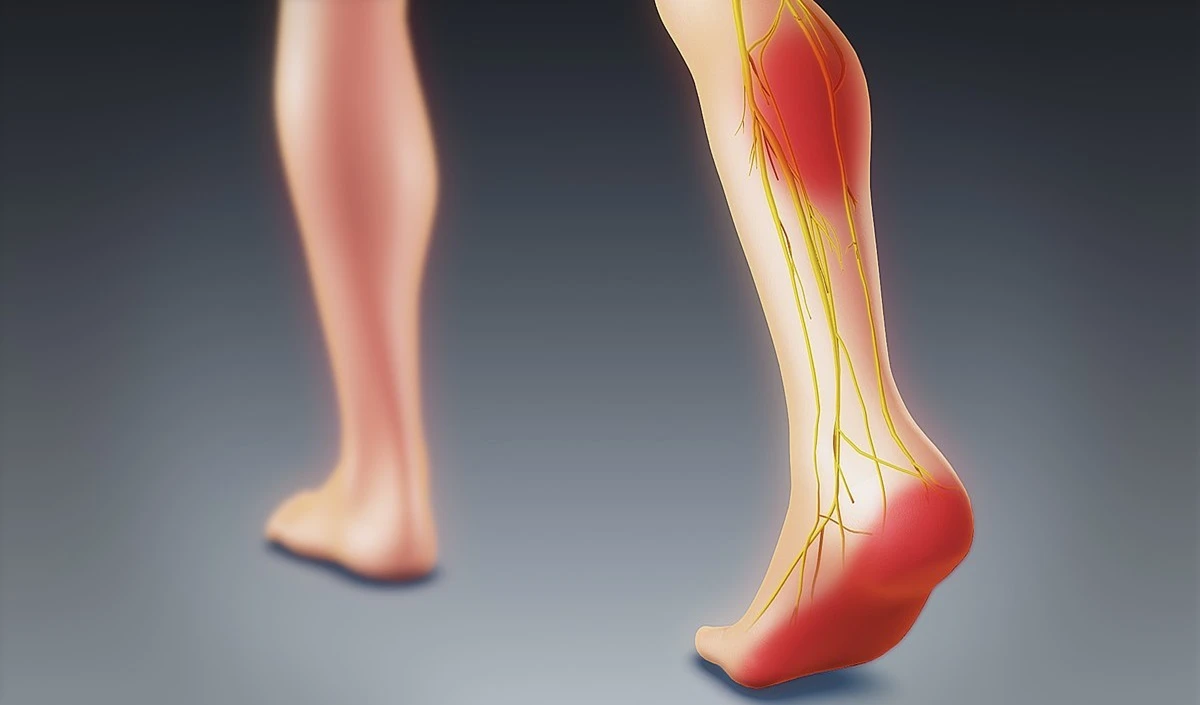 Health Tips: सुबह उठते ही Feet Pain है गंभीर संकेत, Vitamin D और B12 की भारी कमी की ऐसे करें पहचान
